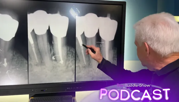 Cliff Ruddle pointing out canal anatomy across three radiographs on a studio monitor during a Ruddle Show taping